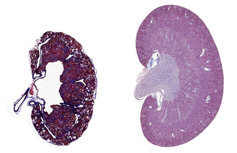 kidney comparison figure